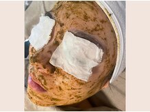 エヴァル 久留米店(ewalu)/人気のハーブピーリング☆