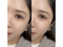 ユニ(uni.)/Lash lift / まつげパーマ