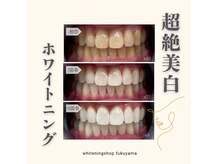ホワイトニングショップ 福山店の雰囲気（圧倒的美白★100%結果重視のセルフホワイトニング）
