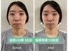 【歪み改善人気No.1】顔の歪み左右差&小顔矯正+姿勢矯正【50分17900→3400】