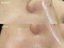 テオリア(TEORIA)/