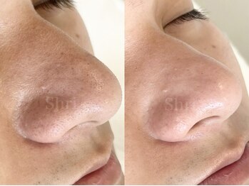 シュリ(Shri)/このツルツルの鼻は？