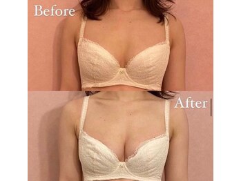 ファッシモ(fascimo)/