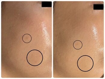 エフェクト 塚口店(effect)/Before After