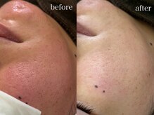 テオリア(TEORIA)/