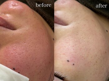 テオリア(TEORIA)/