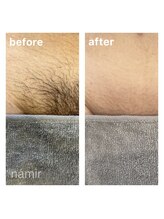 脱毛サロンnamir札幌店【ブラジリアンワックス/美容脱毛/眉毛】～メンズ/レディース～/men's＆lady【VIOワックス】