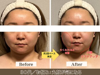 コガオラボ 甲府店(KOGAO LABO)/お客様☆Before&After☆