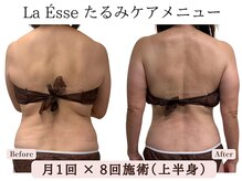ラエッセ(La Esse)/背中を美しく引き締め！