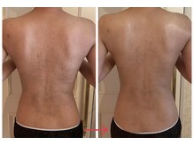 ソラ(Sola)/ビフォーアフター