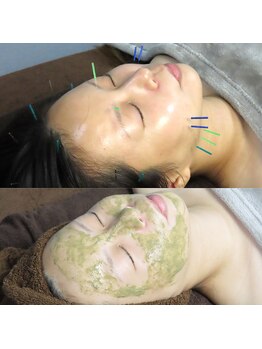 はりめぐり/美容鍼とハーブピーリング