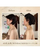 エソール(essor)/痩身だけじゃない！姿勢矯正も◎