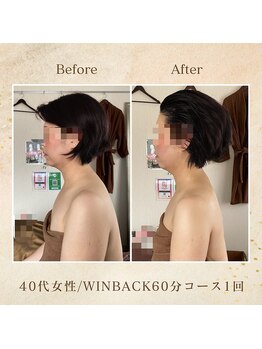 エソール(essor)/痩身だけじゃない!姿勢矯正も◎