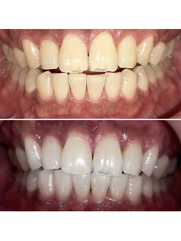 ラブホワイトニング 新宿店(LOVEホワイトニング)/結果重視のホワイトニング