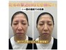 【たるみ＆小顔ケア】EMSロングでグッと引き上げ！￥4300