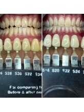 トウキョウスワーズ 池袋店(TOKYO SWRS)/#ホワイトニング #池袋 #渋谷