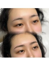 レアファースト/ハリウッドブロウリフト