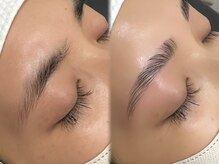 イーアップ(e-up)/アイブロウリフト