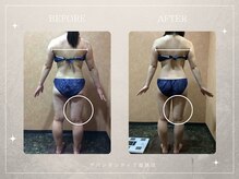 アバンダンティア 姫路店/★キャビテーション★