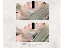 エスポワールカルド(Espoir caldo)/