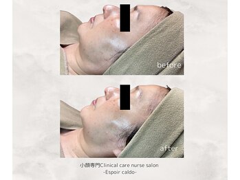 エスポワールカルド(Espoir caldo)/