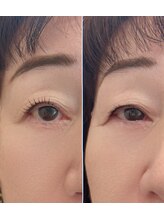 バンデエステティック(BANDE esthetic)/似合わせパーマ