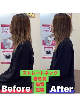 ヒデ整体院(Hide整体院)/産後骨盤矯正で歪み腰痛開き改善