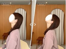 リリーフポート フェミナ鍼灸整体院 大濠公園店/お悩み：首肩の痛み・頭痛