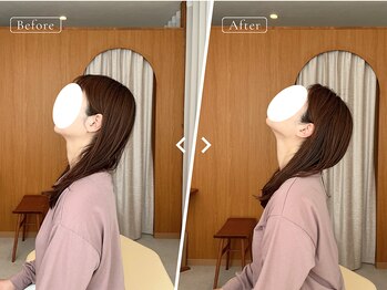 リリーフポート フェミナ鍼灸整体院 大濠公園店/お悩み：首肩の痛み・頭痛