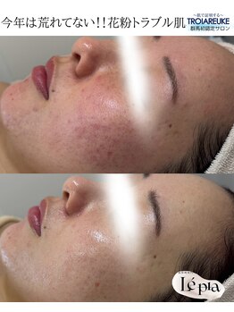 レピア(Le'pia)/トロイアルケ|SEN管理