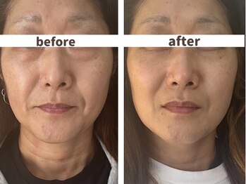 韓美 表参道店(HANMI)/サーマトリックス[表参道]