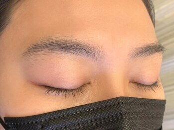 アイマジックピュア 札幌大通店(EYE MAJIC pure)/before