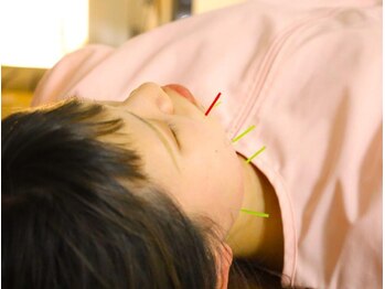 本厚木 リターナル(ReTurnal)/美容鍼/フェイシャル