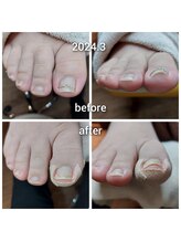 爪切り屋 足楽/爪を平に