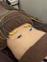 ハリマジック 代官山(HARI MAGIC)/【代官山/鍼灸/美容鍼】