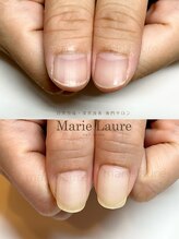 マリーロール 梅田店(Marie Laure)/深爪矯正/自爪育成/自爪風