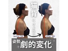 小顔フェイスラボ 名駅店(小顔 Face Labo.)の雰囲気（整体コルギで肩こり&首コリ解消しながら、猫背・巻き肩も改善◎）