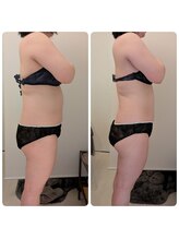 ワイズ(Y's)/お腹8回目