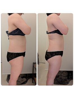 ワイズ(Y's)/お腹8回目