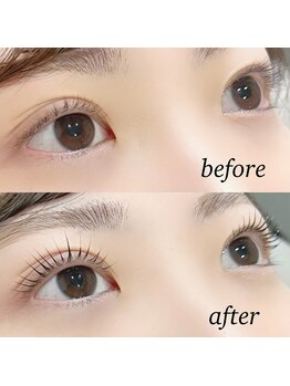 アイ(_i)/ラッシュリフト