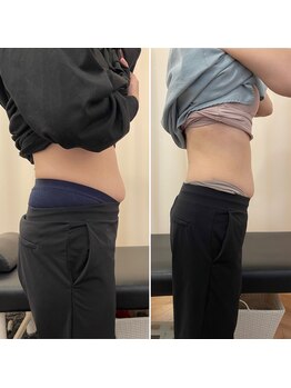 ナオ接骨院(NAO接骨院)/Before/After