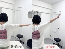 寿 千葉院(KOTOBUKI)/腕が上がらないとお悩みの方