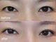 アイラブ(eye love)の写真