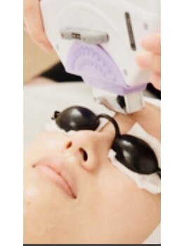 ティエラ(Tierra)/光フェイシャル、顔脱毛