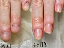 クオーレ(Cuore)の雰囲気（深爪/広がり爪/チビ爪/二枚爪など【爪のコンプレックス】改善◎）
