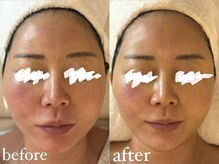 フォー(For...)/美容医療後ケア◇クリスティーナ