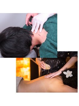 ソフトリー/鍼とアロマテラピーを同時に