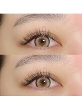 リンク(Linq)/バインドロック100束