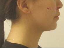 メディケア 新宿/元祖小顔トレーニング