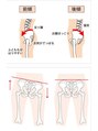 南寺方整骨院&nbsp;骨盤の歪みや反り腰などもお任せください♪